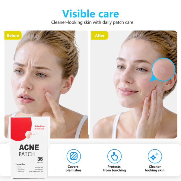 mighty patch before after Hero Mighty Patch Acne